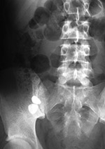 Pepto bismal tablets