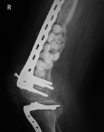 Antibiotic beads