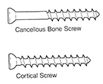 Cortical and cancellous bone screws
