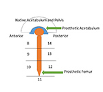Hip zones lateral view