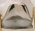 Rotating platform knee prosthesis