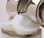 Rotating platform knee prosthesis