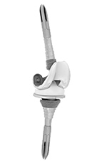 Sigma constrained knee system