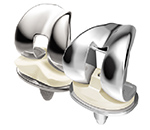 LCS Complete Knee System from DePuy Synthes