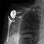 Hardware attenuation