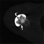 Hardware attenuation