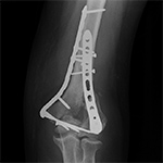 Suboptimal dual energy CT
