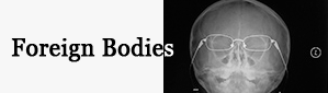 Foreign Bodies